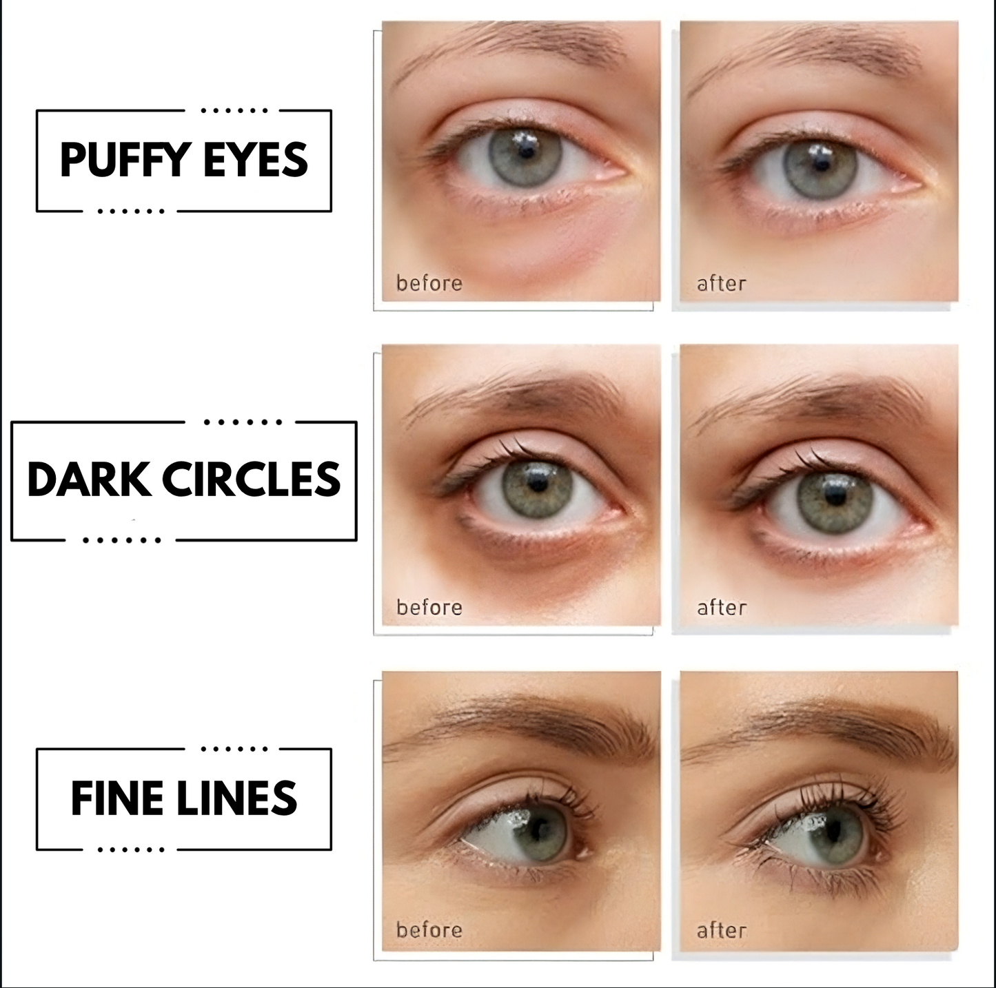 Hydrating Under Eye Patches with Rice Essence for Dark Circles and Eye Bags