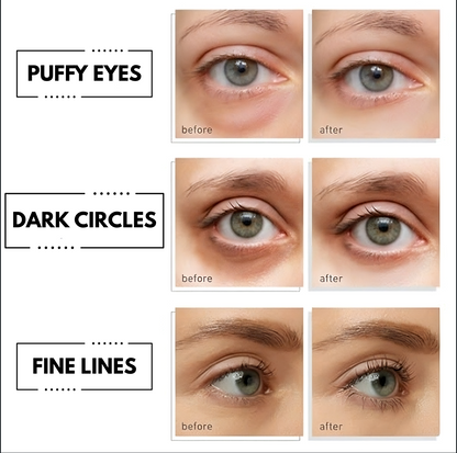 Hydrating Under Eye Patches with Rice Essence for Dark Circles and Eye Bags